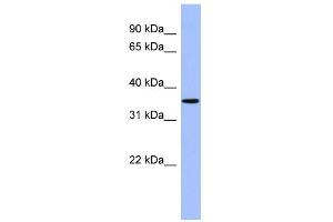 WB Suggested Anti-PPM1A Antibody Titration: 0. (PPM1A Antikörper  (Middle Region))