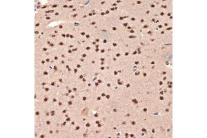 Immunohistochemistry (IHC) image for anti-Cold Inducible RNA Binding Protein (CIRBP) antibody (ABIN7266452)
