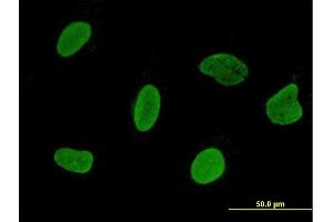 Immunofluorescence of monoclonal antibody to C15orf15 on HeLa cell. (RSL24D1 Antikörper  (AA 1-150))