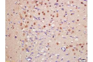 Formalin-fixed and paraffin embedded rat brain labeled with Anti-HDAC3/HD3 Polyclonal Antibody, Unconjugated  at 1:200 followed by conjugation to the secondary antibody and DAB staining (HDAC3 Antikörper  (AA 31-130))