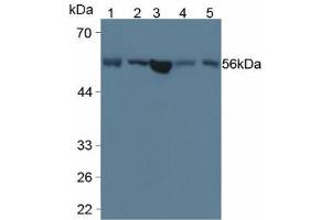 Figure. (LPCAT3 Antikörper  (AA 122-233))