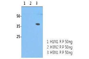 Image no. 1 for anti-Influenza Hemagglutinin HA1 Chain antibody (Influenza A Virus H5N1) (AA 17-338) (ABIN1107749) (Influenza Hemagglutinin HA1 Chain Antikörper (Influenza A Virus H5N1) (AA 17-338))