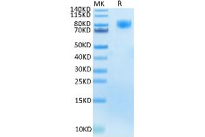 Human M-CSF R Tris-Bis PAGE under reduced condition. (CSF1R Protein (AA 20-512) (His-Avi Tag))