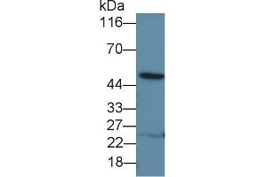 Detection of IL13Ra1 in Porcine Liver lysate using Polyclonal Antibody to Interleukin 13 Receptor Alpha 1 (IL13Ra1) (IL13 Receptor alpha 1 Antikörper  (AA 203-376))