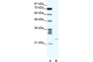 Western Blotting (WB) image for anti-BCL2-Related Protein A1 (BCL2A1) antibody (ABIN2463721) (BCL2A1 Antikörper)