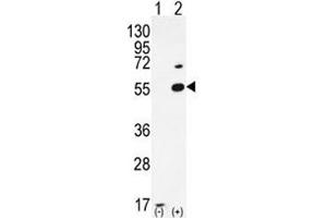 Western blot analysis of PRMT2 antibody and 293 cell lysate either nontransfected (Lane 1) or transiently transfected (2) with the PRMT2 gene. (PRMT2 Antikörper  (AA 22-53))