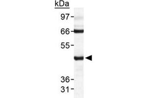 Western blot analysis of TARDBP in HeLa whole cell extract with TARDBP polyclonal antibody . (TARDBP Antikörper  (AA 350-414))