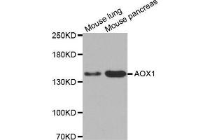 Western blot analysis of extracts of various cell lines, using AOX1 antibody. (AOX1 Antikörper  (AA 340-590))