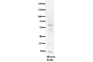 WB Suggested Anti-PDE9A Antibody Titration:  5% Milk  ELISA Titer:  dilution: 1:500  Positive Control:  Mouse Brain lysate
