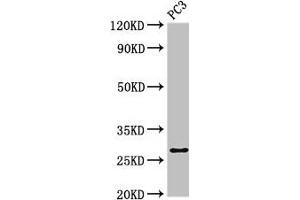 Western Blot Positive WB detected in: PC-3 whole cell lysate All lanes: IL34 antibody at 4 μg/mL Secondary Goat polyclonal to rabbit IgG at 1/50000 dilution Predicted band size: 28 kDa Observed band size: 28 kDa (IL-34 Antikörper  (AA 191-240))