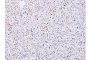 IHC-P Image Immunohistochemical analysis of paraffin-embedded U87 xenograft, using COX2, antibody at 1:100 dilution. (PTGS2 Antikörper  (C-Term))