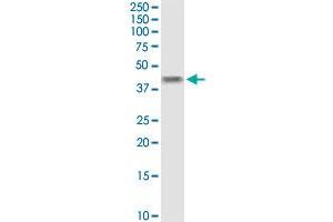 Western Blotting (WB) image for anti-UDP-Gal:betaGlcNAc beta 1,4- Galactosyltransferase, Polypeptide 4 (B4GALT4) (AA 1-344) antibody (ABIN522142)