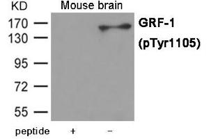 Western blot analysis of extracts from Mouse brain tissue using GRF-1 (Phospho-Tyr1105) Antibody. (GRLF1 Antikörper  (pTyr1105))