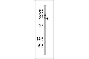Image no. 1 for anti-Caspase 6, Apoptosis-Related Cysteine Peptidase (CASP6) (pSer257) antibody (ABIN358091) (Caspase 6 Antikörper  (pSer257))