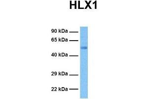 Host:  Rabbit  Target Name:  HLX1  Sample Tissue:  Human Ovary Tumor  Antibody Dilution:  1. (HLX Antikörper  (Middle Region))