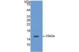 Detection of Recombinant HEXb, Mouse using Polyclonal Antibody to Hexosaminidase B Beta (HEXb) (HEXB Antikörper  (AA 101-217))
