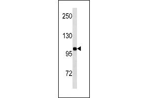 INSR Antibody (N-term) (ABIN1881461 and ABIN2843249) western blot analysis in MDA-M cell line lysates (35 μg/lane). (Insulin Receptor Antikörper  (N-Term))