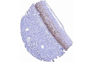 In squamous epithelium occludin positivity is regularly seen but staining is reduced or absent in basal and superficial cell layers scaled (Occludin Antikörper  (AA 282-415))