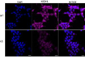 Immunocytochemical staining of HeLa cells using NSDHL antibody (ABIN7799539), 1:1,000), Top panel: wild-type (WT), Bottom panal: NSDHL shRNA knockdown (KD).
