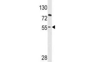 Western blot analysis of PAX8 antibody and HL-60 lysate (PAX8 Antikörper  (AA 285-313))