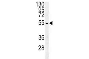 Beta III Tubulin antibody western blot analysis in HepG2 lysate (TUBB3 Antikörper  (AA 36-63))