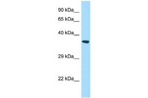 WB Suggested Anti-STARD7 Antibody Titration: 1. (STARD7 Antikörper  (N-Term))