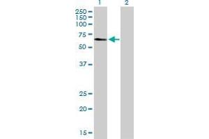 Western Blot analysis of TADA3L expression in transfected 293T cell line by TADA3L MaxPab polyclonal antibody. (TADA3L Antikörper  (AA 1-369))
