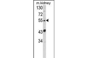 Western blot analysis of SIL1 Antibody (Center) (ABIN652450 and ABIN2842305) in mouse kidney tissue lysates (35 μg/lane).