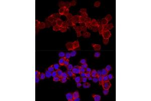 Immunofluorescence (IF) image for anti-Integrin alpha-L (ITGAL) (AA 26-306) antibody (ABIN3015542)