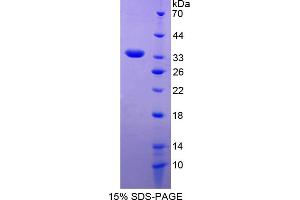 Image no. 1 for Myosin IG (MYO1G) (AA 754-1018) protein (His tag) (ABIN6238030) (MYO1G Protein (AA 754-1018) (His tag))