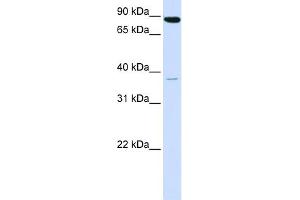 WB Suggested Anti-ACSL3 Antibody Titration:  0. (Acsl3 Antikörper  (N-Term))