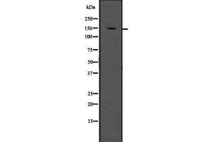 Western blot analysis of LDLR using HeLa whole  lysates. (LDLR Antikörper  (Internal Region))