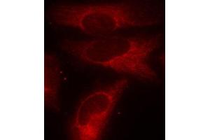 Immunofluorescence staining of methanol-fixed Hela cells using Phospho-YWHAZ-S58 antibody. (14-3-3 zeta Antikörper  (pSer58))