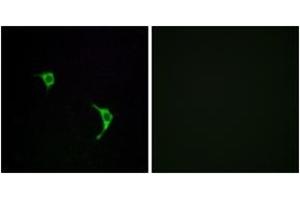 Immunofluorescence analysis of LOVO cells, using SAPK/JNK (Ab-183) Antibody. (SAPK, JNK (AA 166-215) Antikörper)