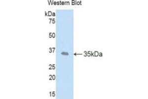 WB of Protein Standard: different control antibodies against Highly purified E. (LEFTY1 CLIA Kit)