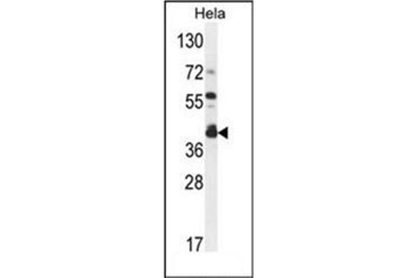 DEGS2 Antikörper  (C-Term)