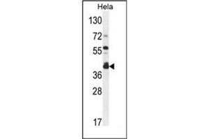 Western blot analysis of DEGS2 Antibody (C-term) in Hela cell line lysates (35ug/lane). (DEGS2 Antikörper  (C-Term))
