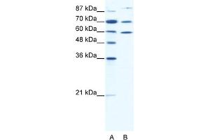 WB Suggested Anti-HSP90AB1 Antibody Titration:  0. (HSP90AB1 Antikörper  (N-Term))