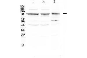 Western blot analysis of CD166/ALCAM using anti- CD166/ALCAM antibody .