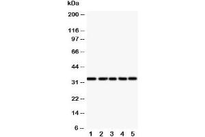 Western blot testing of E2F6 antibody and Lane 1:  HeLa;  2: COLO320;  3: A549;  4: MCF-7;  5: SMMC-7721 cell lysate (E2F6 Antikörper  (Middle Region))