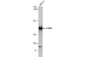 WB Image CD66e antibody detects CD66e protein by western blot analysis. (CEACAM5 Antikörper)