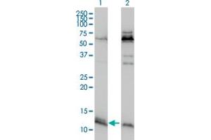 Western Blot analysis of ATPIF1 expression in transfected 293T cell line by ATPIF1 monoclonal antibody (M01), clone 3E2. (ATPase Inhibitory Factor 1 Antikörper  (AA 1-106))