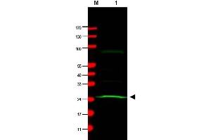 Western Blotting (WB) image for anti-MAD2 Mitotic Arrest Deficient-Like 1 (Yeast) (MAD2L1) antibody (ABIN400793) (MAD2L1 Antikörper)