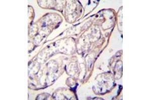 Immunohistochemistry (Paraffin-embedded Sections) (IHC (p)) image for anti-Pyrroline-5-Carboxylate Reductase Family, Member 2 (PYCR2) (AA 96-124), (Middle Region) antibody (ABIN954394)