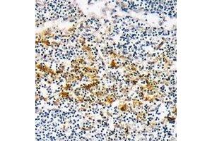 Immunohistochemical analysis of CYSLTR1 staining in human lymph node formalin fixed paraffin embedded tissue section.