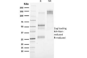 SDS-PAGE Analysis Purified Cytokeratin 3 Mouse Monoclonal Antibody (KRT3/2130). (Keratin 3 Antikörper)
