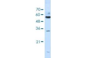 Western blot analysis of Jurkat cell lysate with KHDRBS3 polyclonal antibody . (KHDRBS3 Antikörper  (AA 281-330))
