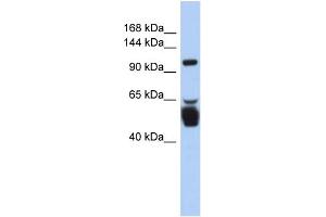 WB Suggested Anti-LRRC8B Antibody Titration:  0. (LRRC8B Antikörper  (N-Term))