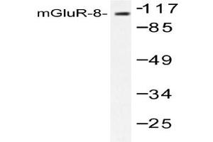 Image no. 1 for anti-Glutamate Receptor, Metabotropic 8 (GRM8) antibody (ABIN265441) (GRM8 Antikörper)