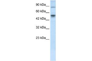 WB Suggested Anti-MDM4 Antibody Titration: 0. (MDM4-binding Protein Antikörper  (N-Term))